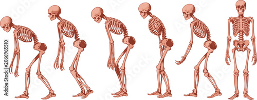 Fotografía Detailed medical illustration showing human skeletal evolution from a hunched gait to a healthy upright posture on white