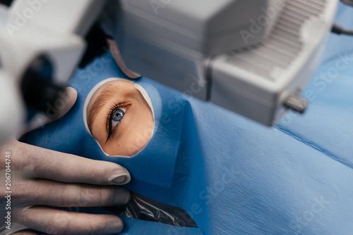 Quadro su tela Patient's eye isolated with a sterile surgical drape during ophthalmic surgery under an operating microscope
