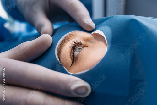 Bild auf Leinwand Patient's eye visible during microsurgery with a blue surgical drape and gloved