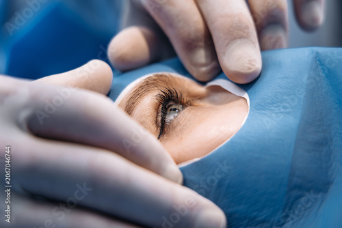 Принти на полотні Patient's eye being carefully exposed during microsurgery with gloved hands hold