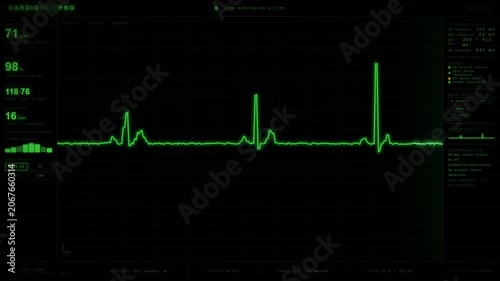 Green Medical Ekg Heart Rate Monitor Display Loop With Vital Signs And Electrocardiogram Data