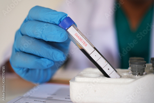 Foto Hand holding a blood sample with the word DIABETES written on it