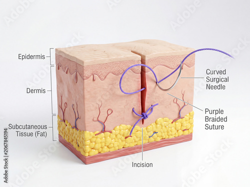 Surgical suture 3D illustration of skin layer incision with needle for plastic surgery medical education chart.