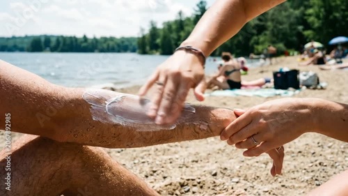 Woman applying sunscreen to man's leg at sunny lakeside beach