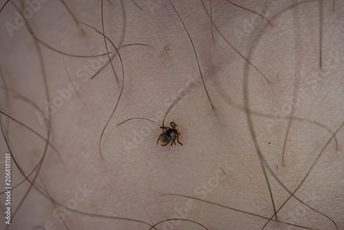 Fotografie Extreme macro photograph showing a tick attached to human skin among body hair