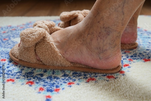 Close-up of an elderly woman's legs. Feet of an elderly lady in soft, cozy slippers