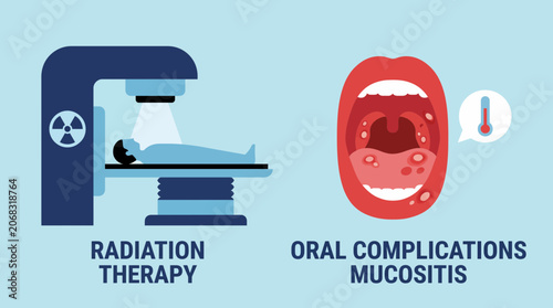 Fotografie Radiation Therapy Oral Complications Mucositis