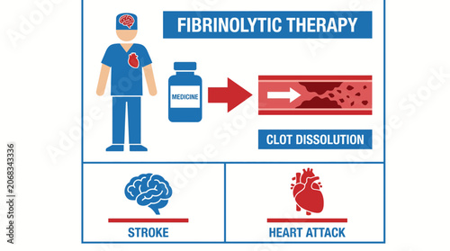Schilderij op canvas Fibrinolytic Therapy Clot Dissolution Stroke Heart Attack Treatment
