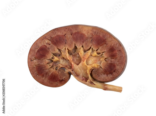 Cross section view of a human kidney showing internal anatomy and structure for medical science education isolated on transparent background