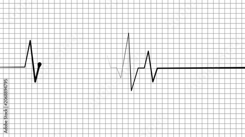 Heartbeat line pulse spike and flat line medical concept for heart health monitoring and emergency care animation