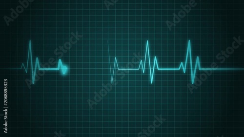 Electrocardiogram line heartbeat rhythm and medical monitor trace animation