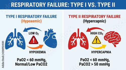 Fotografie Respiratory Failure Type I vs Type II Hypoxemia and Hypercapnia