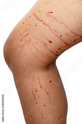 drops of berry juice on the skin