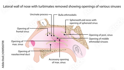 Cuadro en lienzo Lateral wall of nose with turbimates removed showing openings of various sinuses, the lateral nasal wall with turbinates removed, highlighting the drainage pathways