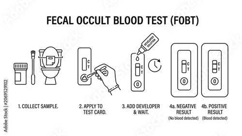 Fecal Occult Blood Test procedure illustration.