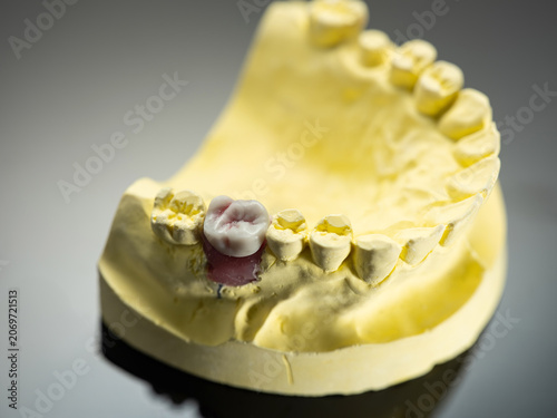 The image of a denture