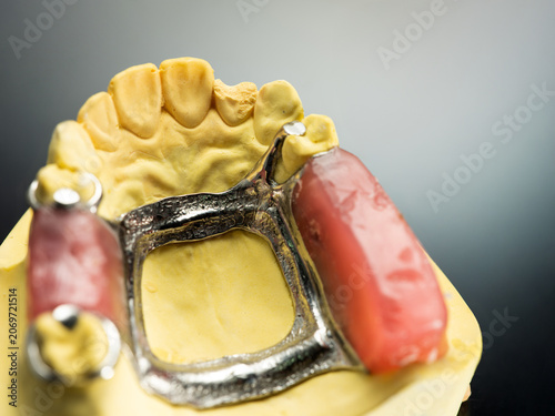 The image of a denture
