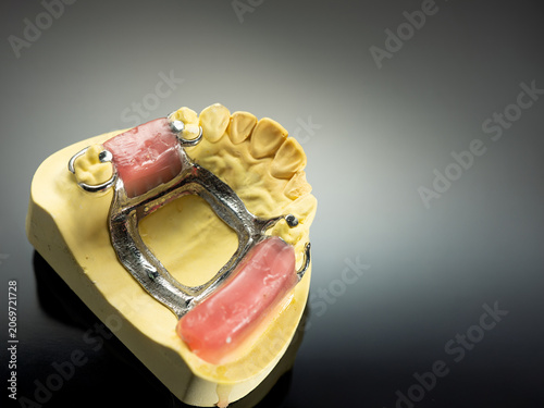 The image of a denture