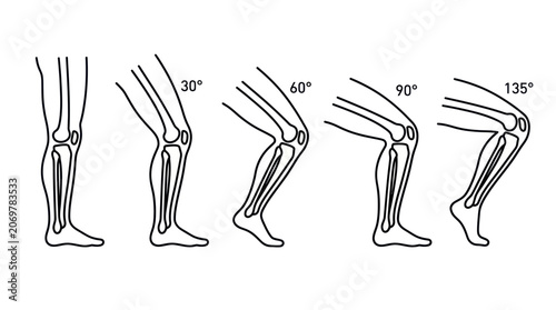 Bild auf Leinwand Knee Joint Flexion Angles Diagram: 30, 60, 90, 135 Degrees