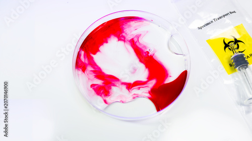 Abstract red liquid microbial growth  in glass petri dish with biohazard icon on white background. Healthcare and medical theme concept.