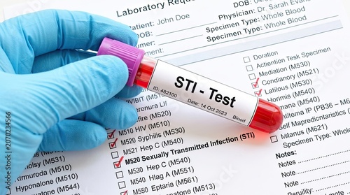 Medical professional in blue gloves holds blood sample tube labeled sti test for sexually transmitted infection diagnosis over laboratory request form with checked boxes for various diseases