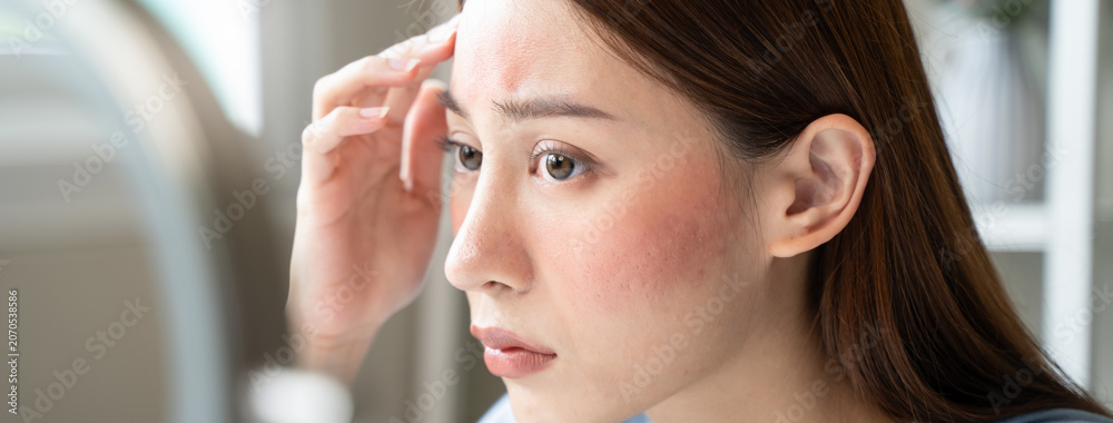 Fototapeta premium Sensitive skin with cosmetology, Asian young woman looking at red spot on her face from cosmetic allergy in the mirror.