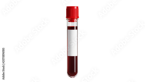 Cuadro en lienzo Isolated laboratory tube filled with human blood, ready for medical examination