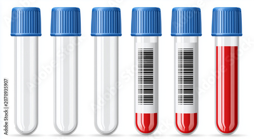 Set of medical test tubes with blue caps for blood analysis, including empty, labeled with barcode, and filled with blood samples.
