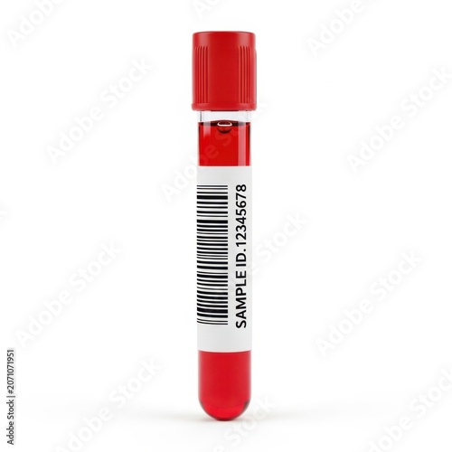 A Single Red Capped Medical Blood Collection Tube Against A White Background