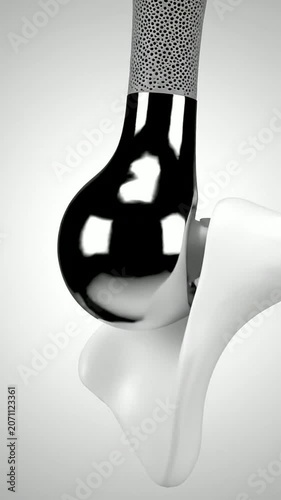 Realistic 4K Visualization of a Detailed Artificial Joint Medical Device in Motion Against a Neutral Background