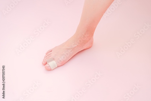 Close up of bunion, hallux valgus. Silicone finger toe separator on woman's feet