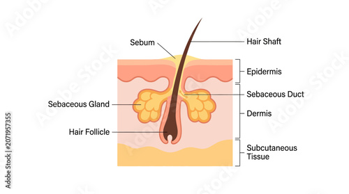 Cuadro en lienzo Detailed anatomical illustration of a hair follicle and sebaceous gland in human skin with labeled components