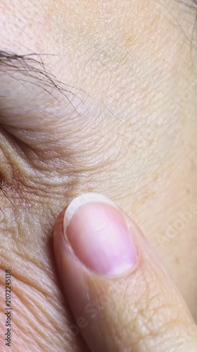 Middle aged woman smooths out wrinkles around her eyes with gentle massage. Natural eye area texture, self-care concept. Close-up real time footage.