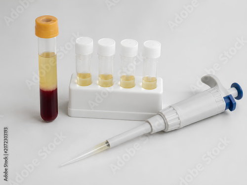 Clinical serum aliquoting setup with cryovials and micropipette
