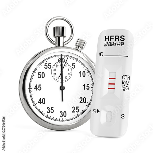 Hantavirus Diagnosis Concept. HFRS Rapid Test Cassette Beside Stopwatch. 3d Rendering