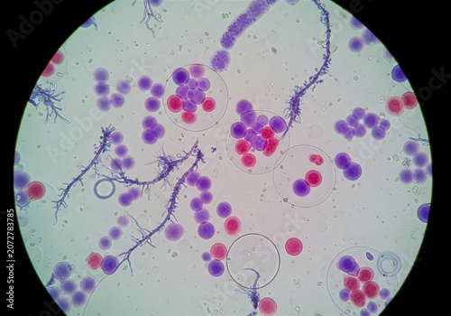 Microscopic View of Blood Cells and Bacteria Under Laboratory Microscope for Medical Research