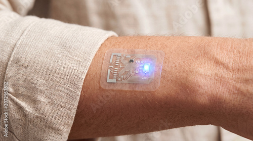 A semi-transparent medical patch with silver circuits and a glowing blue light is attached to a person's forearm, close up.