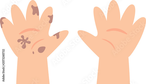 Dirty hands and clean hands
