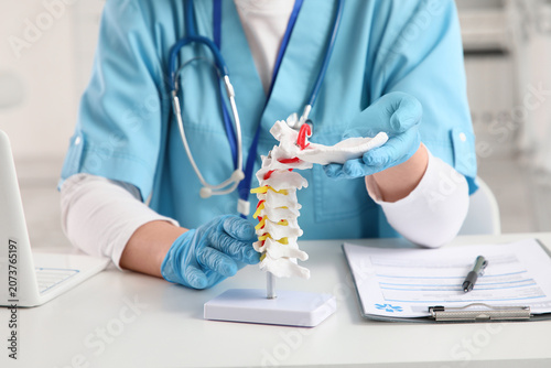 Female doctor with spine model at table in clinic, closeup