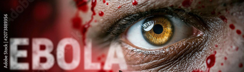Ebola Virus Close-Up: A chi...