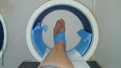 Quadro su tela Person's bare foot with kinesiology tape receiving physical therapy treatment in