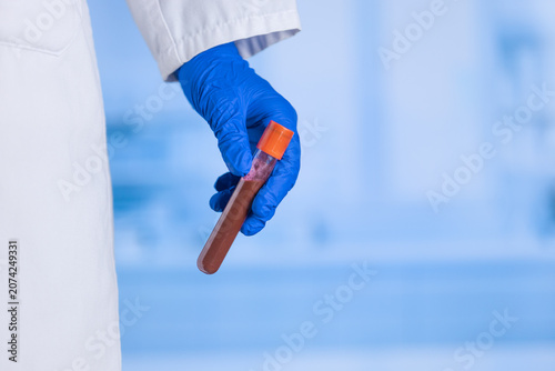 Person wears white lab coat. Blue gloves hold test tube. Test tube has orange cap and brown liquid. Background is soft blue blur. Image shows lab environment. Good for medical or scientific topics