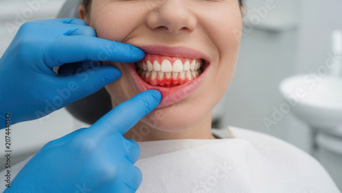 Dentist examining patient's inflamed gums in a dental office, gum disease diagnosis and professional oral health care