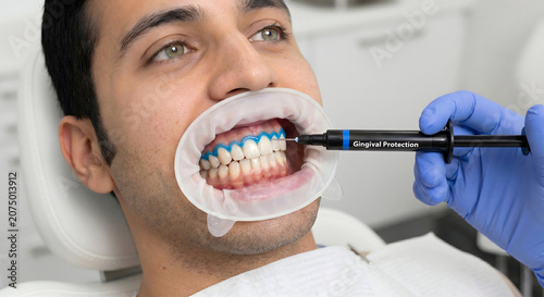 Aplicación de barrera gingival fotopolimerizable a paciente, protección de encías y tejidos blandos