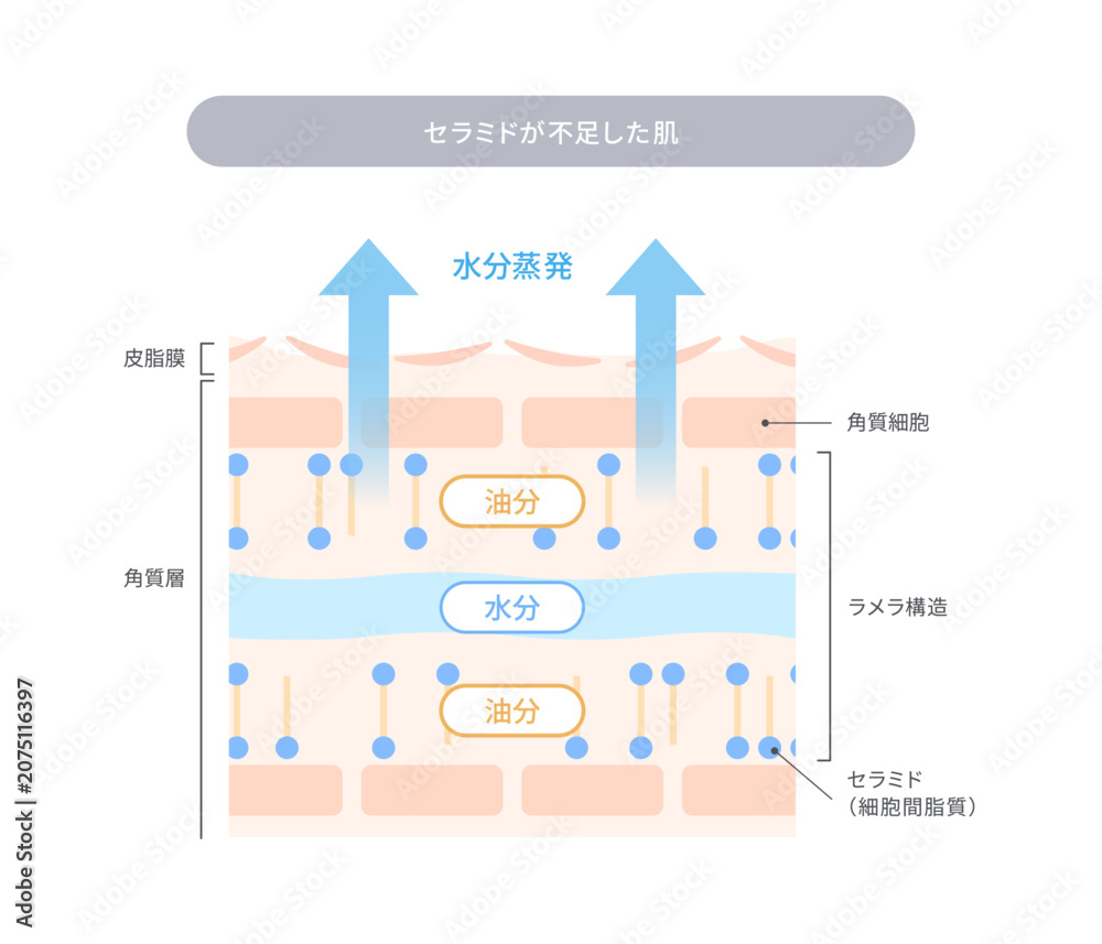 Obraz premium セラミド不足によるバリア機能の低下と水分蒸発を解説する肌断面図イラスト