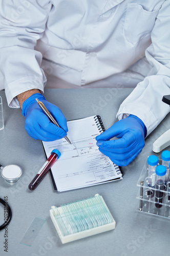 Cuadro en lienzo Blood sample collection tubes in laboratory rack beside microscope