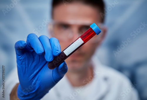 Foto Blood sample identification, clinical laboratory specimen