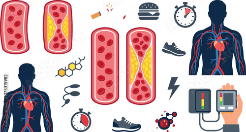Photos Cholesterol and Atherosclerosis Medical Vector Set Featuring Normal vs Blocked A