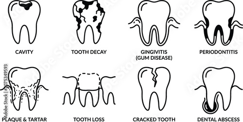 Cuadro en lienzo Dental Problems and Oral Disease Line Icon Set Featuring Cavity Tooth Decay Ging