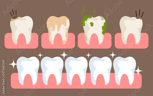 Dental Problems and Healthy Teeth Comparison Illustration Set